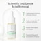 LANBENA 10% Salicylic Acid Serum, Acne Repair, Dead Skin Peels, Relieve Redness, Soothing Calming for Acne Prone Sensitive Facial Skin Care