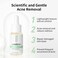 LANBENA 10% Salicylic Acid Serum, Acne Repair, Dead Skin Peels, Relieve Redness, Soothing Calming for Acne Prone Sensitive Facial Skin Care
