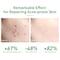 LANBENA 10% Salicylic Acid Serum, Acne Repair, Dead Skin Peels, Relieve Redness, Soothing Calming for Acne Prone Sensitive Facial Skin Care