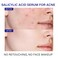 2% Salicylic Acid Serum for Face Acne Treatment, Acne Serum for Oily Skin, Moisturizer Face Serum for Acne Spot, Blackhead &amp; Whitehead Remover, Pore Reducer, Acne Skincare for Women, Men, Adult, Teens
