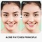 Invisible Pimple Patches &ndash; Tea Tree Oil Hydrocolloid Formula for Recovery, Quick Healing, Non-Drying Smooth Skin- 2 Sizes Acne Patches for Covering Zits and Blemishes, Blends Into Skin (36ct)