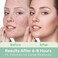 Large Pimple Patches for Face and Body, Hydrocolloid Acne Patches for Big Zit Breakouts and Blemish, Acne Spot Treatment w/Tea Tree Oil for Chin, Nose, Forehead, Body, Back, Neck &amp; Chest