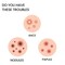 Star-Shaped Acne Patches for Face - Cute Pimple Patches with Hydrocolloid, Tea Tree Oil &amp; Hyaluronic Acid   Gentle Overnight Spot Treatment for Skin Repair