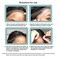 Lace Glue Wigs 2pcs/lot 76ml/2.6OZ - Invisible Bonding Glue Lace Wig Glue Hair Replacement Adhesive Strong Hold Transparent Hair Glue for Lace Wigs, Oily Scalps, Hairpiece