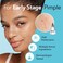 Microdart Acne Patches for Deep Blemishes - 18 Dots - Hydrocolloid Pimple Patch with Salicylic Acid, Azelaic Acid, CICA &amp; Vitamin C - Targets Stubborn Blemishes, Dark Spots &amp; Cystic Acne
