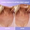 Cleverfy Silicone Chest Wrinkle Pads for D&eacute;collet&eacute; - 3-Pack of T-Shape Reusable Anti-Wrinkle Patches