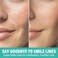TRIXES Smile Line Patches - Anti Wrinkle Patches, Silicone Face Patches for a Radiant, Youthful Appearance,Say Goodbye to Smile Lines,16pcs