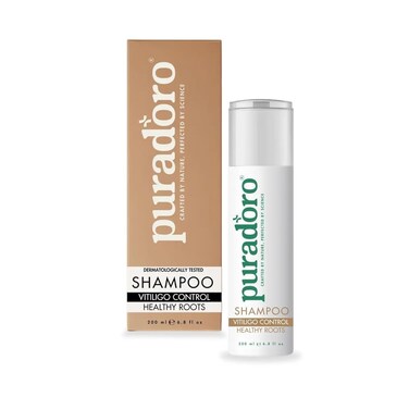 Vitiligo Control &amp; Healthy Roots Shampoo &ndash; Soothes Scalp, Supports Pigmentation, Infused with Aloe Vera, Biotin &amp; Essential Oils for Men &amp; Women