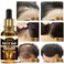 Dendas Biotin Hair Growth Serum - Anti-Hair Loss Essential Oil Treatment, Prevents Thinning, Repairs Dry &amp; Frizzy Hair, Promotes Fast Hair Growth, 1 fl oz (30ml) Unisex, Black/gold