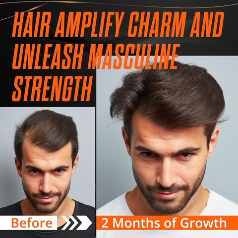Abera Hair Growth Serum - Natural Regrowth Treatment for Hair &amp; Beard with Biotin &amp; Castor Oil, Economy Combo (3 Serums + Gift)