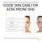 Niacinamide 10% + Zinc 1%, Face Serum, Even Out Skin Tone, Reduce Fine Lines and Wrinkles, Acne-Prone, Oily, Blemishes, Dullness, Even Complexion