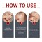 2PCS Paracress Facial Oil, Paracress Serum Organic, Paracress Extract Face Oil, Paracress Oil for Skin