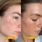 By C&eacute;leste Clarifying LED Mask, Red and Blue Light Therapy Mask For Face, Cute Cat Shape