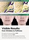 Bewants Neck Lifting &amp; Firming Cream with Centella Asiatica, 2 Pack, Vegan Hyaluronic Acid. Neck and Face Firming Cream Moisturizer for Sagging Skin with Gua Sha Roller