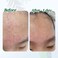 MissDragon Wasabi Cica Biome Blemish Cream (1.69 fl.oz.) &ndash; Vegan Korean Skincare, Soothing Deep Moisturizing Ectoin Cream for Teenagers and Oily Skin