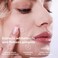 Korean Pimple Patches for Face with Hydrocolloid Patch &amp; Salicylic Acid   Acne Spot Treatment   Invisible Blemish Pimple Stickers   72 (10mm) Acne Dots to Extract Whiteheads &amp; Fast Healing