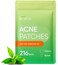 Pimple Patches for Face with Tea Tree Oil. Hydrocolloid Acne Pimple Patches. Blemish Patches, Acne Dots, Pimple Stickers, Acne Patch and Pimple Patch