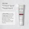 Glytone Acne Spot Treatment Face Cream with 8% Sulfur &amp; 2% Resorcinol, Tinted Acne Treatment for Teenagers, Conceals Blemishes, 1 oz