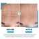 Soti 2.5% Retinol Serum, Reduces Wrinkles, Age Spots, Post-Acne Marks. Stimulates Collagen, Firm Skin, Anti Aging with Hyaluronic Acid, Niacinamide (30ml)