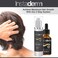Hair Stimulating Growth Serum- Extra Strength, DHT Blocker Hair Regrowth &amp; Follicle Restoration Formula Treatment. Promotes Thicker, Fuller, Longer, Healthier Hair for Men &amp; Women.