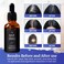 HM Hair Growth Serum with Castor Oil, Biotin, Amino Acids &amp; Ginseng   Prevents Hair Breakage, Hair Loss &amp; Thinning   Scalp Nourishing &amp; Strengthening Formula   Non-Greasy