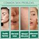 Avocado Skin Care Set,Facial Kit with Facial Cleanser,Toner,Eye Cream,Face Serum,Facial Serum,Face Cream,Lotion &amp; 3PCS Face Mask,Travel Skincare Kit for Women (9PCS)