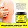 Cream - Fastest Acting Powerful Hives Relief Cream with 100% Natural Formula - Gentle Skin Irritation Cream for Hives Itchiness, Redness &amp; Rashes - for Adults &amp; Kids