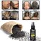Hair Growth Serum for Women &amp; Men - Black Rice Water Spray, Hair Loss Treatment for Damaged, Dry Hair, Hair Regrowth with Castor Oil and Ginger for Thicker, Longer, Fuller Hair
