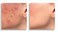 Dermacol Make-Up Cover Colour Light 209 by Dermacol