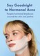 Rael Retinol Chin Mask with Miracle Clear Barrier Cream - Face Masks and Moisturizer, 2 Step Treatment, Niacinamide, Ceramide NP, for All Skin Types, Vegan, Korean Skincare (5 Kits)