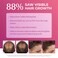 BosleyMD Foam, Extra Strength Thinning Treatment for Hair Loss and Hair Regrowth for Women 2%-5% Topical Solution, Foam/Mousse, 1-month supply, 2 oz