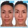 SKINN Cr&egrave;me Reverse with Ferulic Acid, Retinol and Vitamin C-Cr&egrave;me Reverse Intensive-Anti-Aging Cream with Hyaluronic Acid to Plump Skin Vitamin C Help to Improving Tone, Firmness of Skin