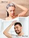HEETA Hair Scalp Massager Brush, Updated Hair Shampoo Brush, Wet &amp; Dry Scalp Exfoliator with Soft Silicone Bristles, Head Massager Washing Hair Care Tool for Women Men Kid, Bright Beige