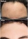 Teenology Conditioner for Teens - Avoid Forehead and Body Acne - Sulfate and Paraben Free, Noncomedogenic, Natural Botanical Extracts, Sweet Mint - 16 oz.