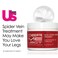 Dermelect Vacial Spider Vein Treatment for Body &amp; Face Anti Aging Cream with Vitamin K, Allantoin, Hyaluronic Acid, Arnica, Shea Butter for Spider Veins, Red Threads, Uneven Skintone 2.2 oz