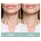 Contours Rx Neck Rescue - Anti-Aging Neck Strips for Crepey Skin - Tighten, Lift and Firm Fine Lines and Wrinkles - Long Lasting Treatment - Organic, Hypoallergenic, Latex Free (30 Count)
