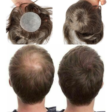Bald Spot Hair Patch Toupee for Men 3.15x3.15inches Full PU Skin Base Cover-up Human Hair Topper Replacement Systems (#4 Light Brown Color)