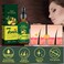Biotin Hair Growth Serum for Hair Loss Regrowth Treatment for Women &amp; Men, 100% Pure Natural Ginger Essential Oil, 2 Fl Oz / 30ML (2 PCS)