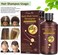 TruuMe Hair Growth Shampoo, Anti Hair Loss Shampoo, Helps Stop Hair Loss, Regrowth Shampoo for Men &amp; Women, 220mL