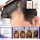 Propidren by HairGenics - DHT Blocker &amp; Hair Growth Capsules to Prevent Hair Loss &amp; Stimulate Hair Follicles, to Stop Hair Loss &amp; Regrow Hair. Proprietary Anti-Hair Loss &amp; Hair Regrowth Treatment.