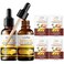 Sadoer Ginger Anti-Hair Loss Oil and Shampoo, Sadoer Ginger Hair Growth Serum + Shampoo, Sadoer Ginger Extract Anti-Hair Loss Treatment Essence Set for Thicker, Stronger, Longer Hair Men &amp; Women (1)