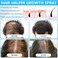 2 Pcs Hair Helper Growth Spray for Thinning Hair, Rice Water Spray for Hair Growth, Anti-Loss Hair Thickening Natural Spray for Hair Regrowth Unisex