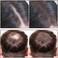 Boobeen Hairline Powder Stick for Thinning Hair, Grey Root Touch-Up and Hair Loss Concealer
