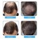 Hair Fibers Spray Refill Powder 100 Grams,Dark Brown,Thinning Fine Hair Loss Concealer,Undetected &amp; Unscented,Refill Exsiting Shaker Bottle