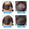 Hair Fibers Spray Refill Powder 100 Grams,Black,Thinning Fine Hair Loss Concealer,Undetected &amp; Unscented,Refill Exsiting Shaker Bottle