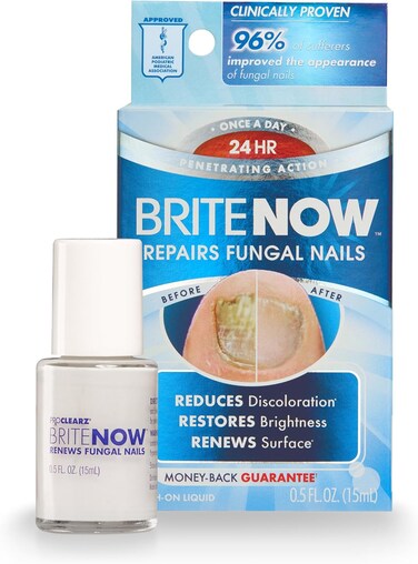 Brite Now Nail Treatment, Restores The Appearance Of Damaged &amp; Discolored Nails, Peel-Away Technology, Brightening &amp; Smoothing Nail Repair, 0.5 Ounce