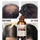 Anti Hair Loss Hair Serum, Repairing Hair Scalp with Herbal Extracts,Scalp Massage Serum Water Base with Ginseng,Ginger,Polygonum Multiflorum for Men and Women,Daily Use