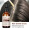 Anti Hair Loss Hair Serum, Repairing Hair Scalp with Herbal Extracts,Scalp Massage Serum Water Base with Ginseng,Ginger,Polygonum Multiflorum for Men and Women,Daily Use