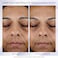 Lanc&ocirc;me​ R&eacute;nergie H.P.N 300-Peptide Face Cream - With Hyaluronic Acid &amp; Niacinamide - Helps Visibly Reduce Lower Face Sagging, Wrinkles, &amp; Dark Spots