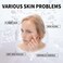 Qingling Crema Para Arrugas, Qingling Face Cream, Qingling Wrinkle Removal Cream, Quinglin Polypeptide Tightening and Anti-Wrinkle Cream, Face Cream, Neck Cream, Eye Cream 3-In-1 (2)